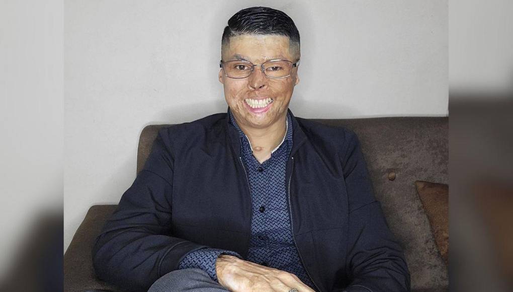 Así lucía el bombero Ever Velásquez antes de quemarse en incendio de ‘La Montañita’