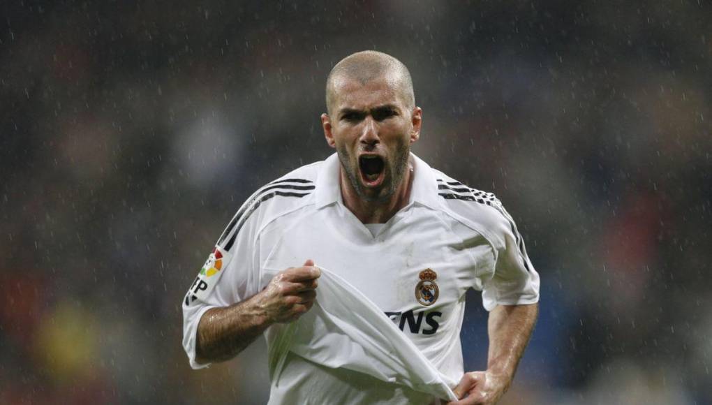 ¿Irreconocibles? Así se veían estos calvos famosos cuando tenían cabello