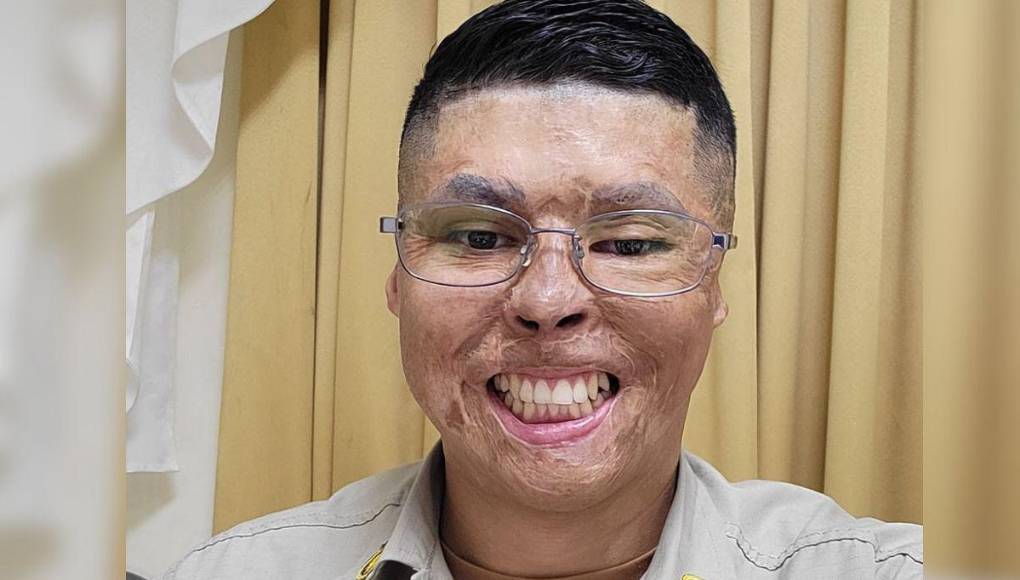 Así lucía el bombero Ever Velásquez antes de quemarse en incendio de ‘La Montañita’