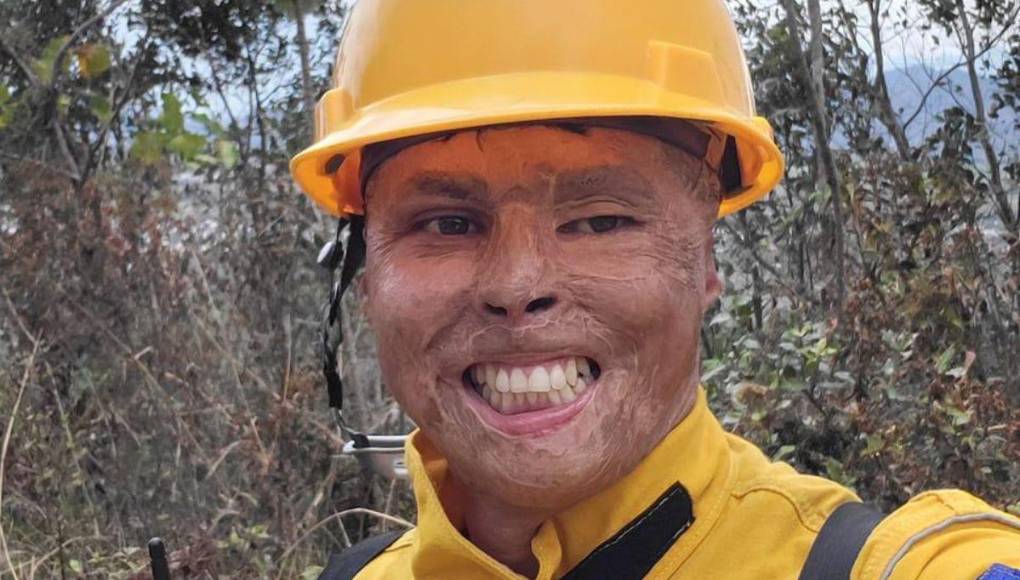 Así lucía el bombero Ever Velásquez antes de quemarse en incendio de ‘La Montañita’