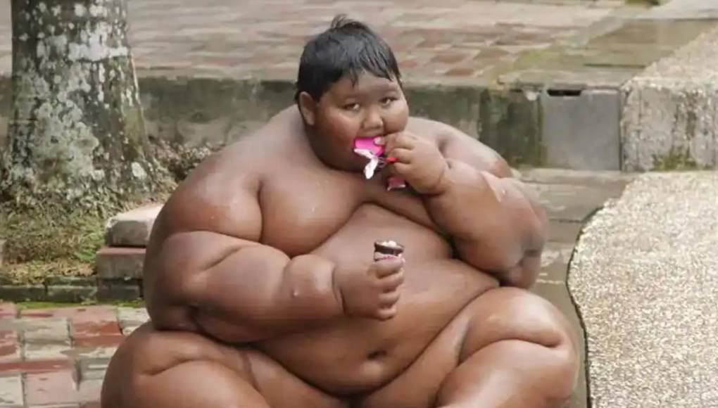 El impactante cambio físico de Arya Permana, el niño más gordo del mundo