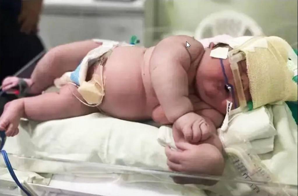 Pesó 16 libras y midió 59 centímetros: así es Angerson, el bebé brasileño más pesado del mundo