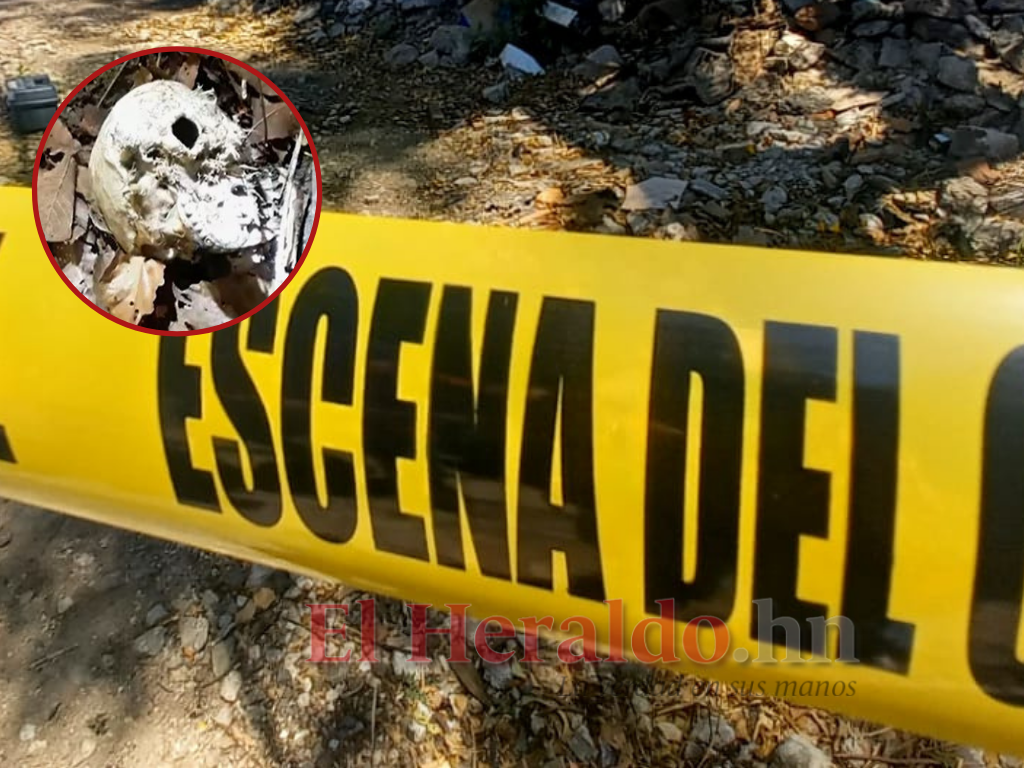 Descubren cráneo humano en aldea La Cuesta de la capital