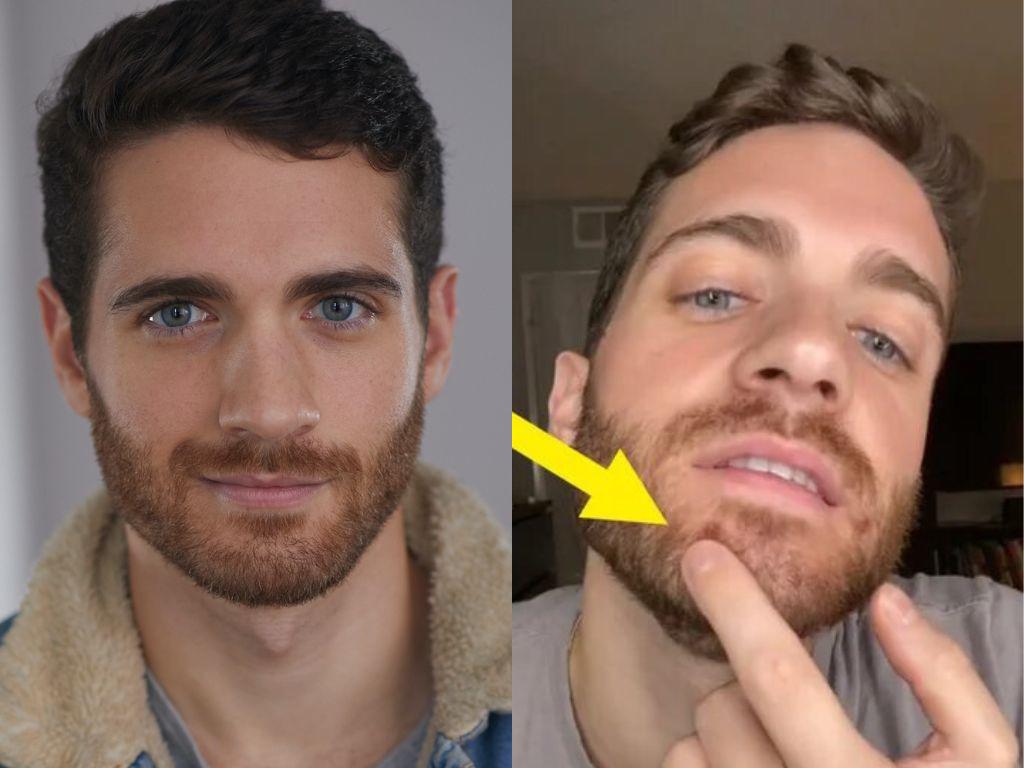 “He tenido covid-19 dos veces, pero la viruela del mono es mucho peor” afirma actor