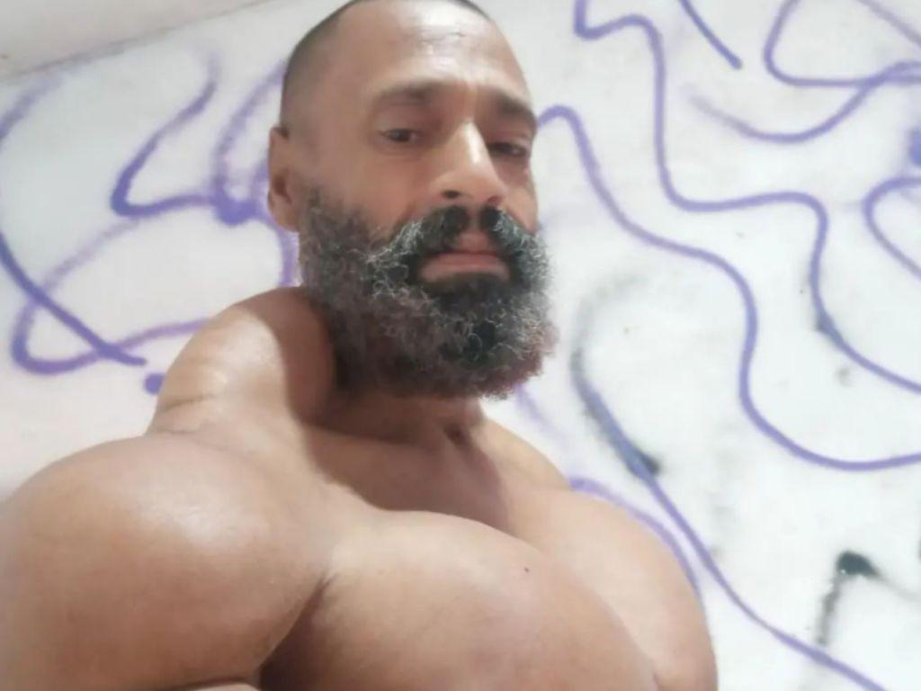 Muere el “Hulk brasileño” tras inyecciones para aumentar sus músculos