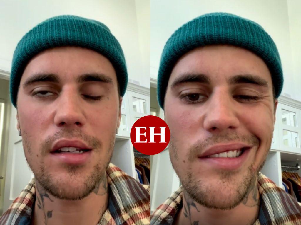 Justin Bieber informa que sufre parálisis facial causada por extraño virus