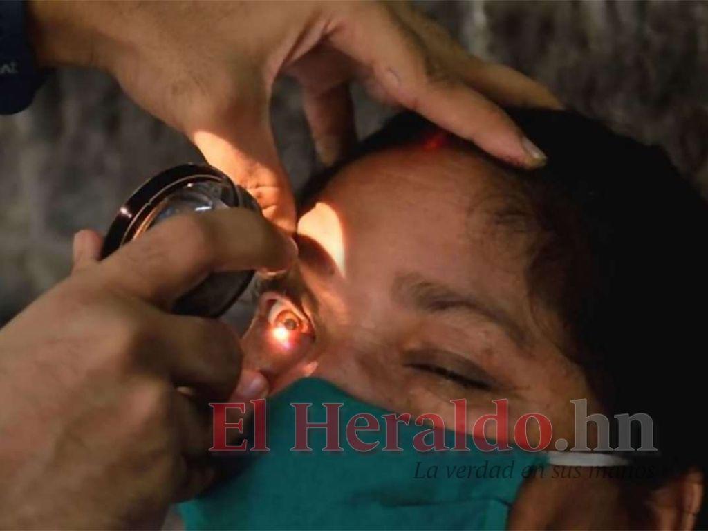 ‘Hongo negro’ prevalece en cuatro departamentos de Honduras