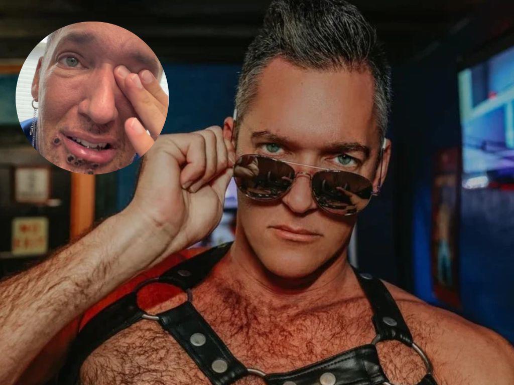 El duro relato de un paciente con viruela del mono: “Me duele existir”