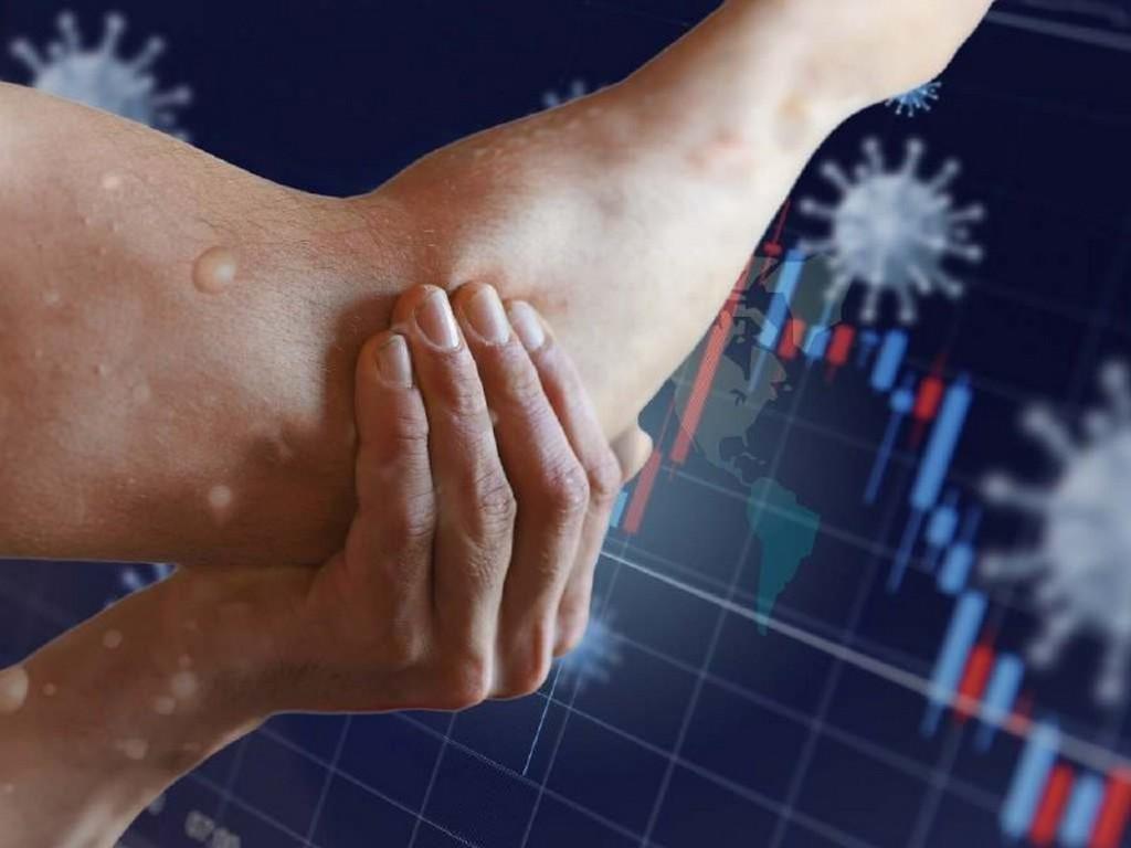 Viruela del mono en Honduras: mitos, verdades y recientes estudios científicos