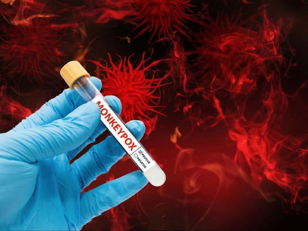 Viruela del mono en Honduras: mitos, verdades y recientes estudios científicos