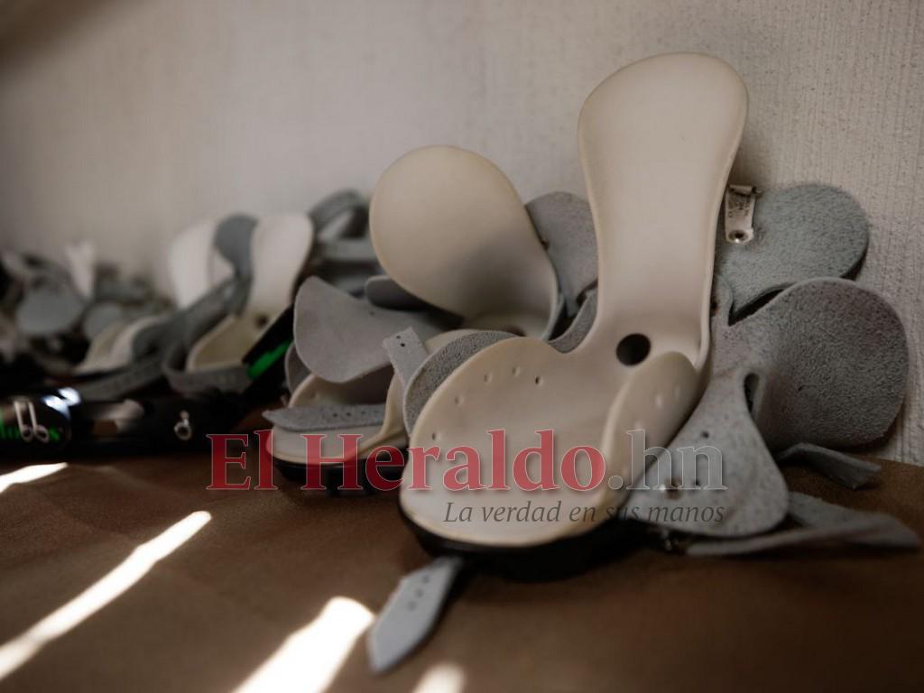 En Honduras el 1% de la población padece de pie equinovaro