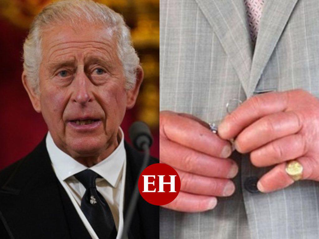 ¿Por qué rey Carlos III tiene rojos e hinchados los dedos de las manos?