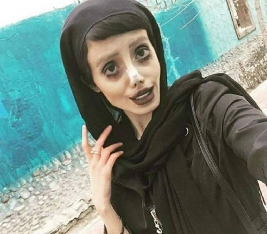 Joven que intentó parecerse a Angelina Jolie rompe el silencio