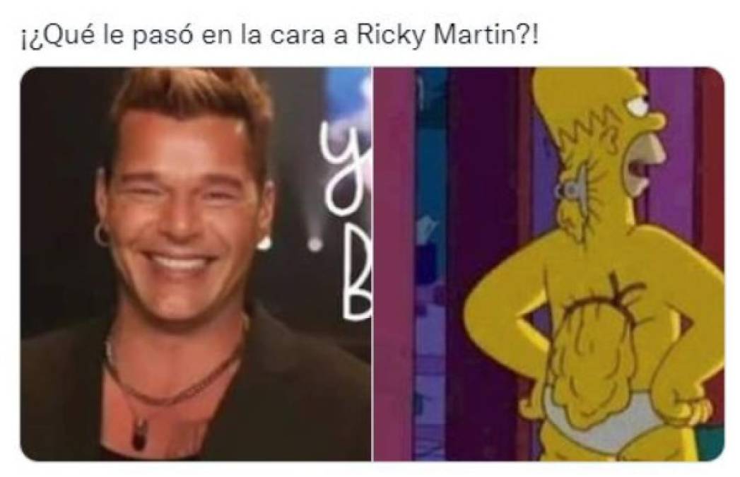 Ricky Martin se retoca la cara y desata una ola de memes