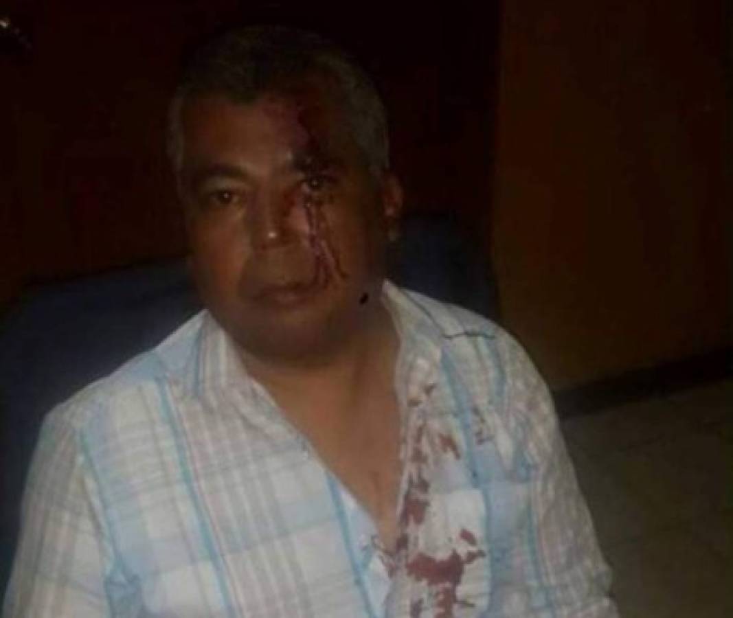 Honduras: Por robarle vehículo golpean a periodista de HCH