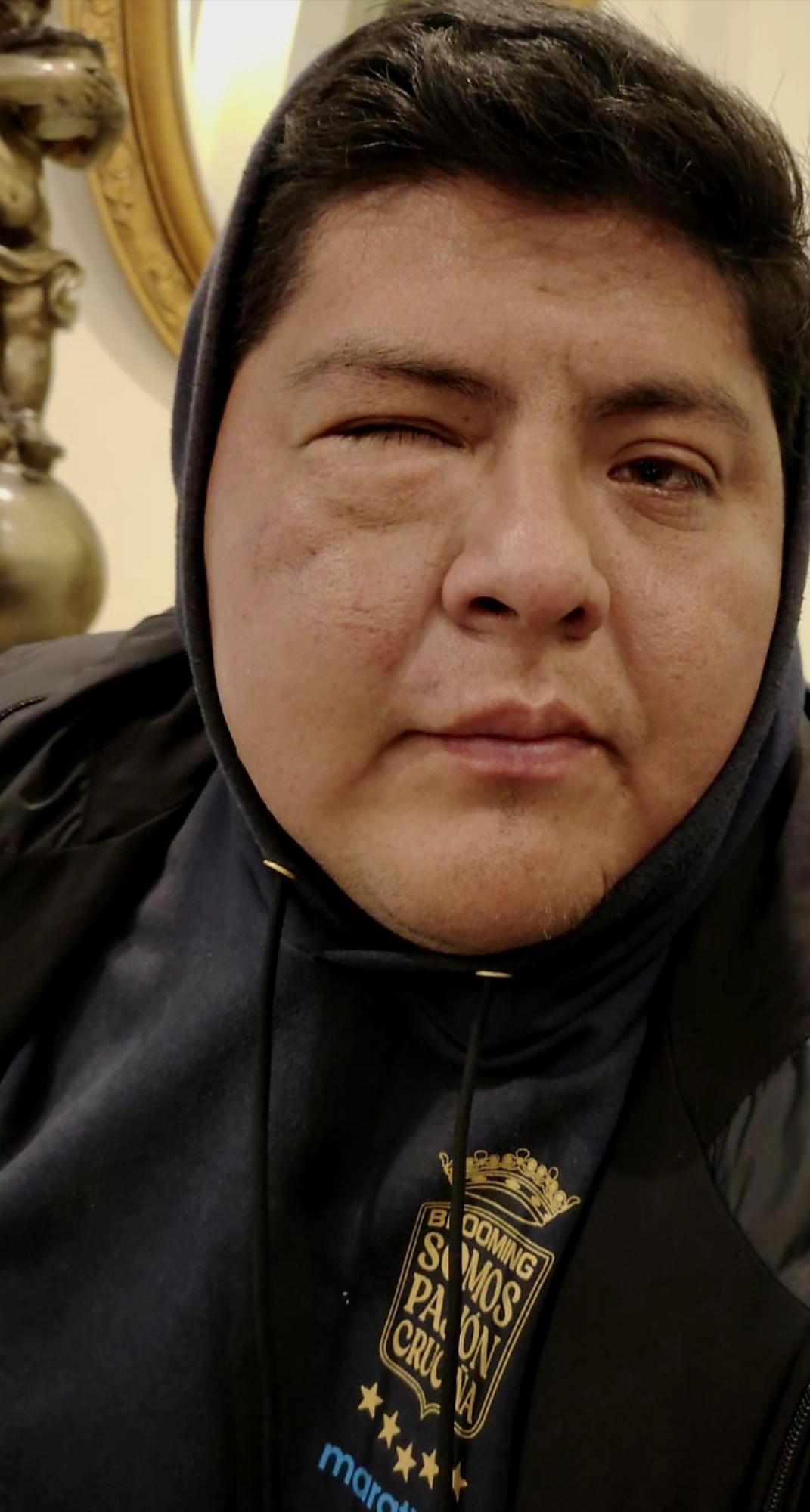 Partido de fútbol termina en batalla campal; 17 expulsados y directivo fracturado