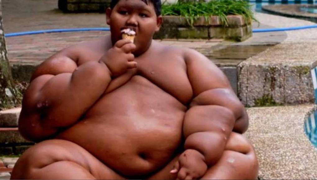 El impactante cambio físico de Arya Permana, el niño más gordo del mundo
