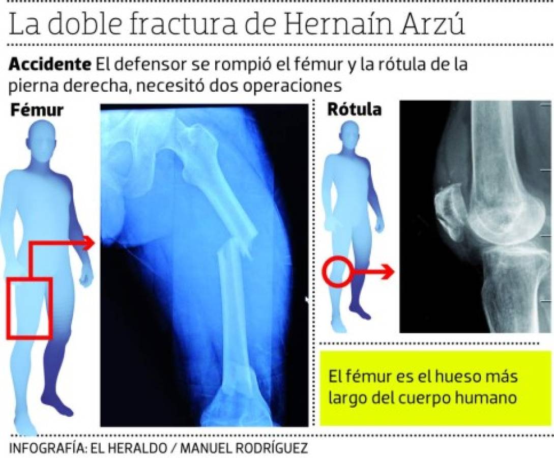 Hernaín Arzú tras accidente: 'No supe cómo me sacaron del carro”