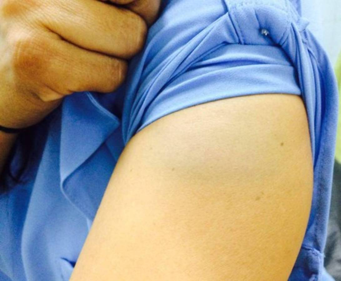 Otra mujer hondureña es golpeada por su pareja