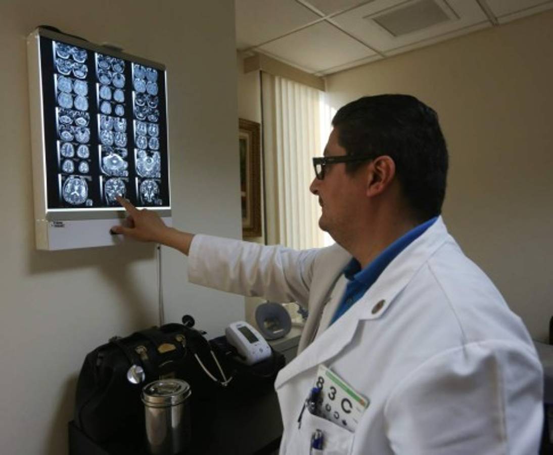 ¿Qué tanto sabe del parkinson?