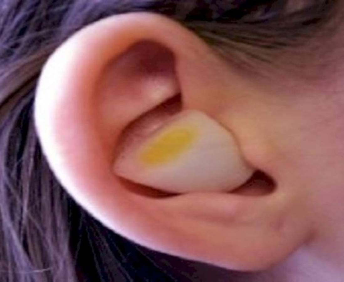 7 fantásticos usos de la Cebolla