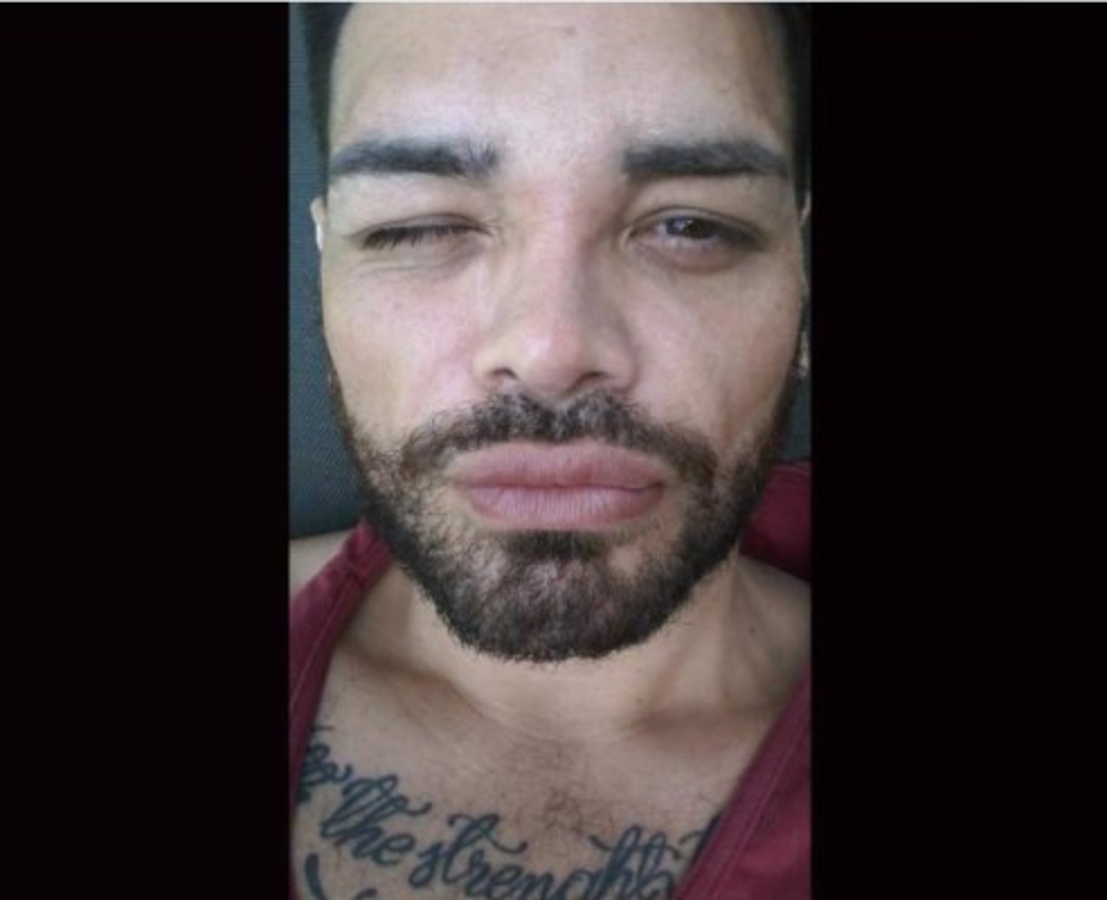 FOTOS: El hombre que se operó para parecerse a Ricky Martin