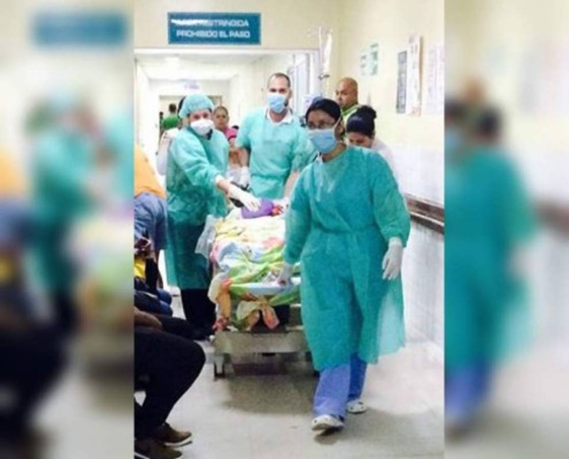 Amputan piernas a niño quemado en Copán