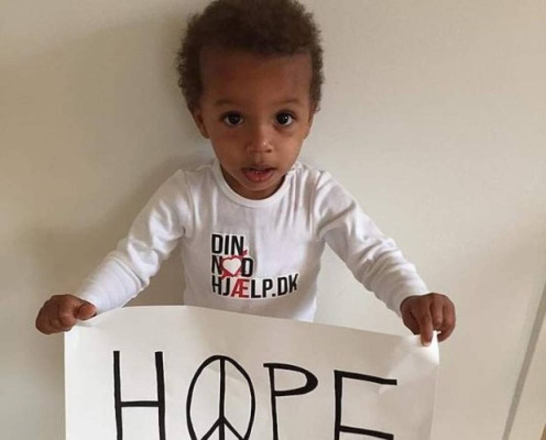 'Hope”, el niño desnutrido que se escapó de las garra de la muerte en África