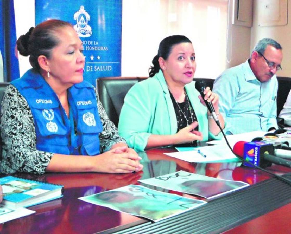 Alerta sanitaria por ocho casos de microcefalia