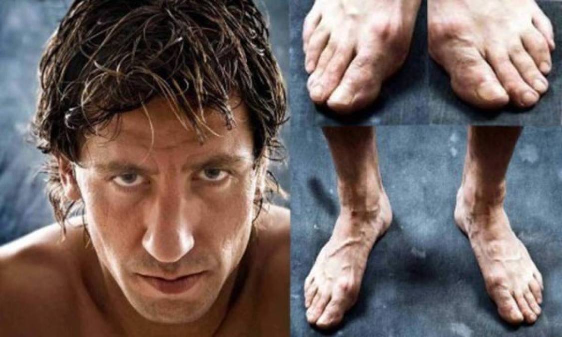 FOTOS: Los mejores futbolistas del mundo tienen los pies más feos