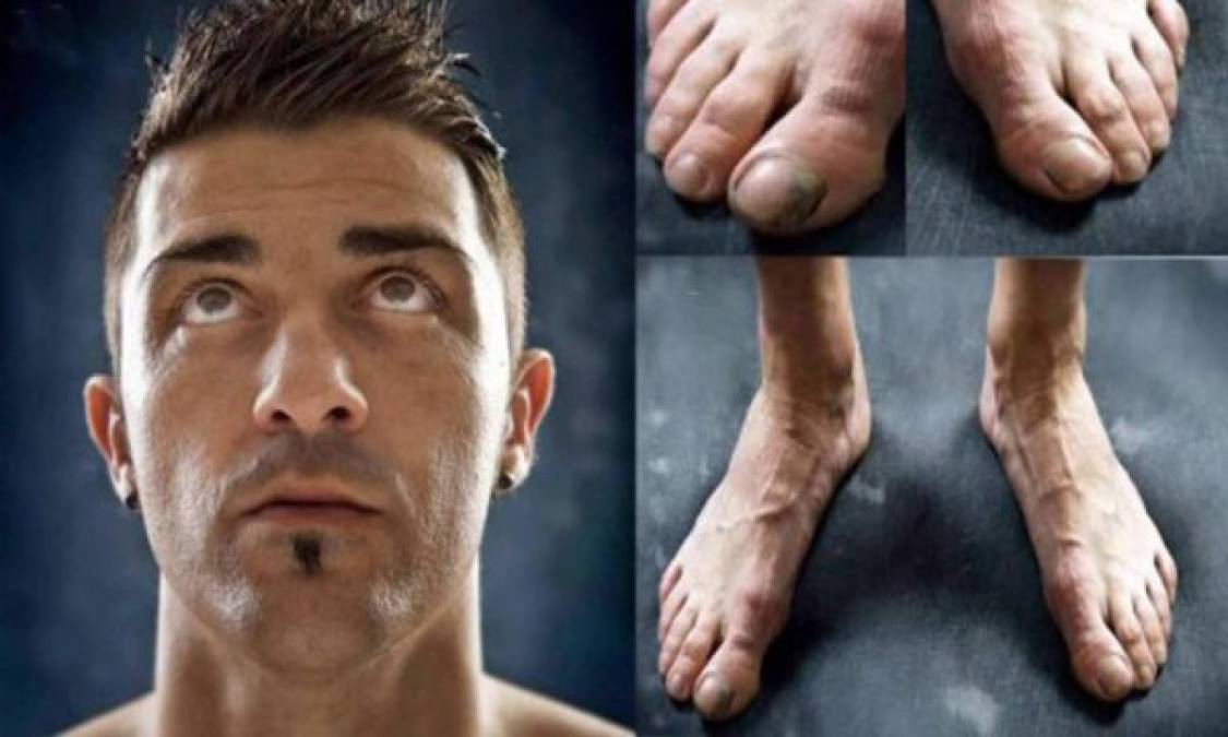 FOTOS: Los mejores futbolistas del mundo tienen los pies más feos