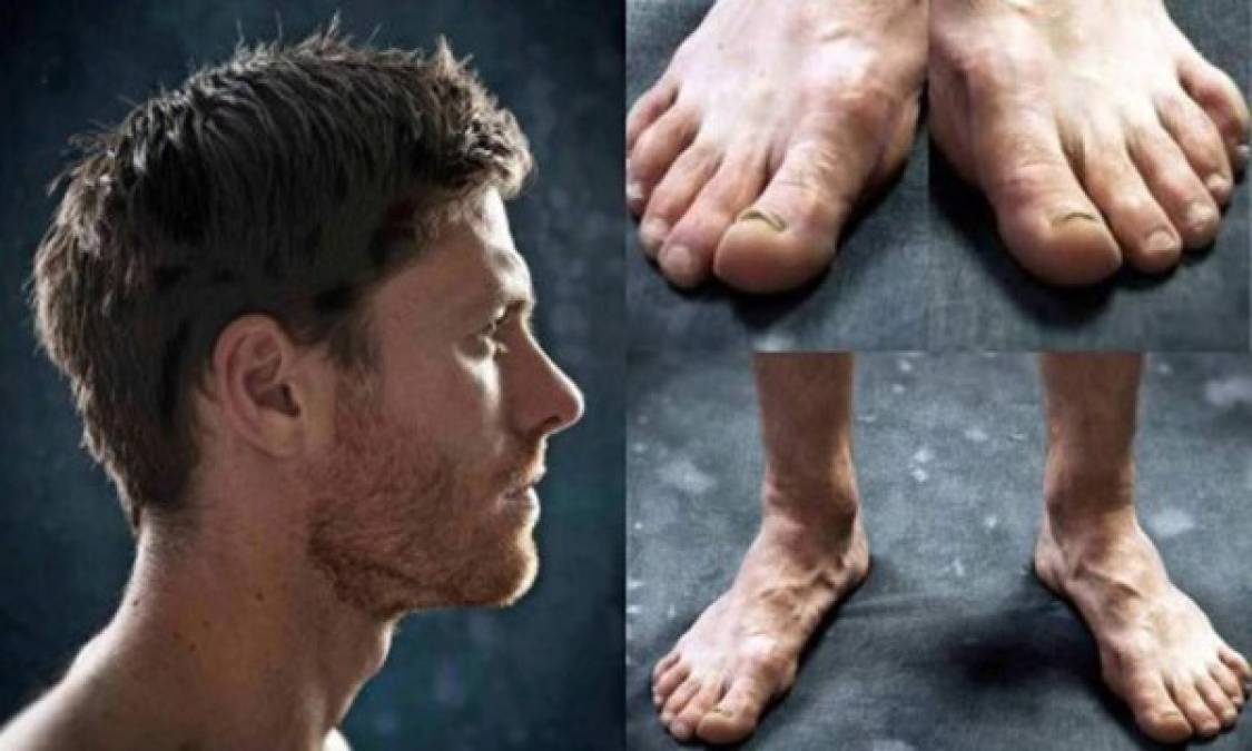 FOTOS: Los mejores futbolistas del mundo tienen los pies más feos