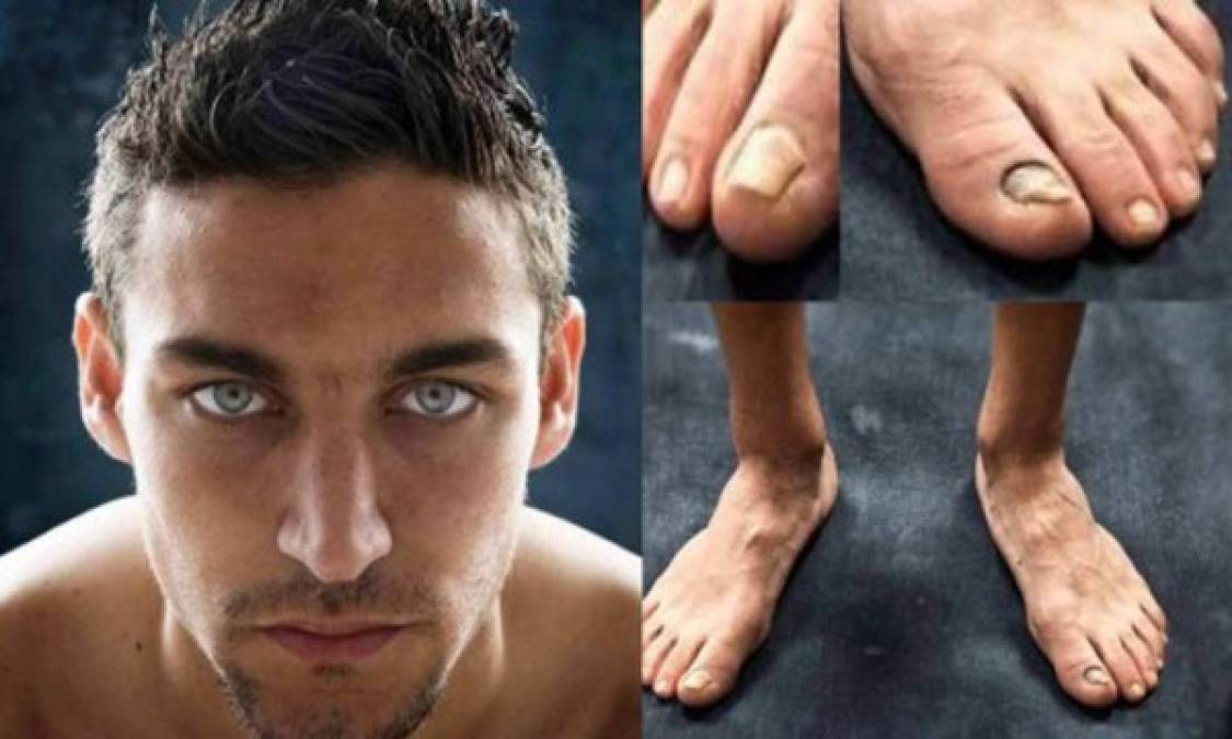 FOTOS: Los mejores futbolistas del mundo tienen los pies más feos