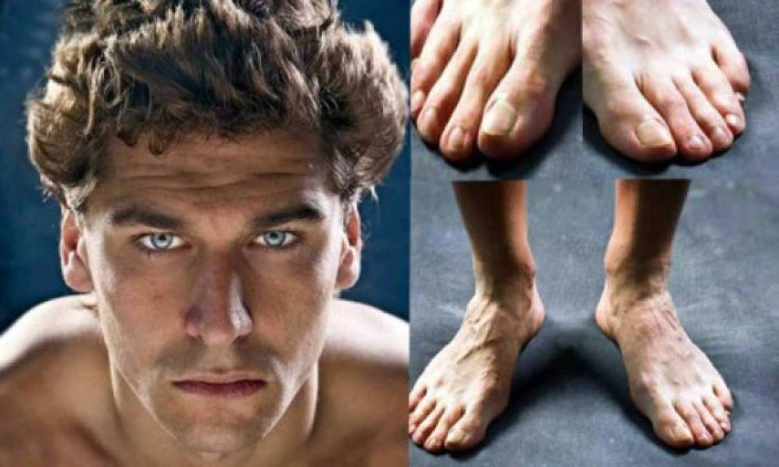 FOTOS: Los mejores futbolistas del mundo tienen los pies más feos