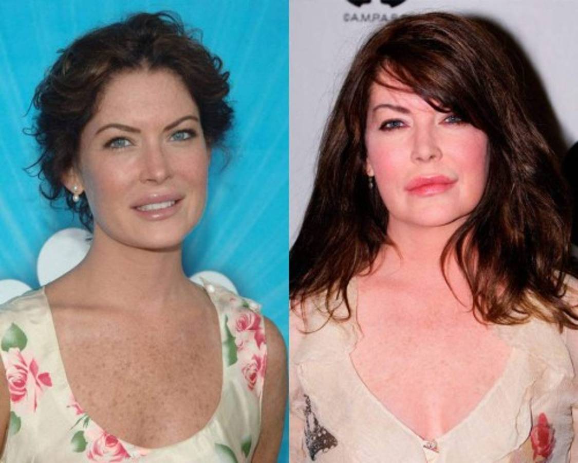 Famosos que lucen terribles después de las cirugías