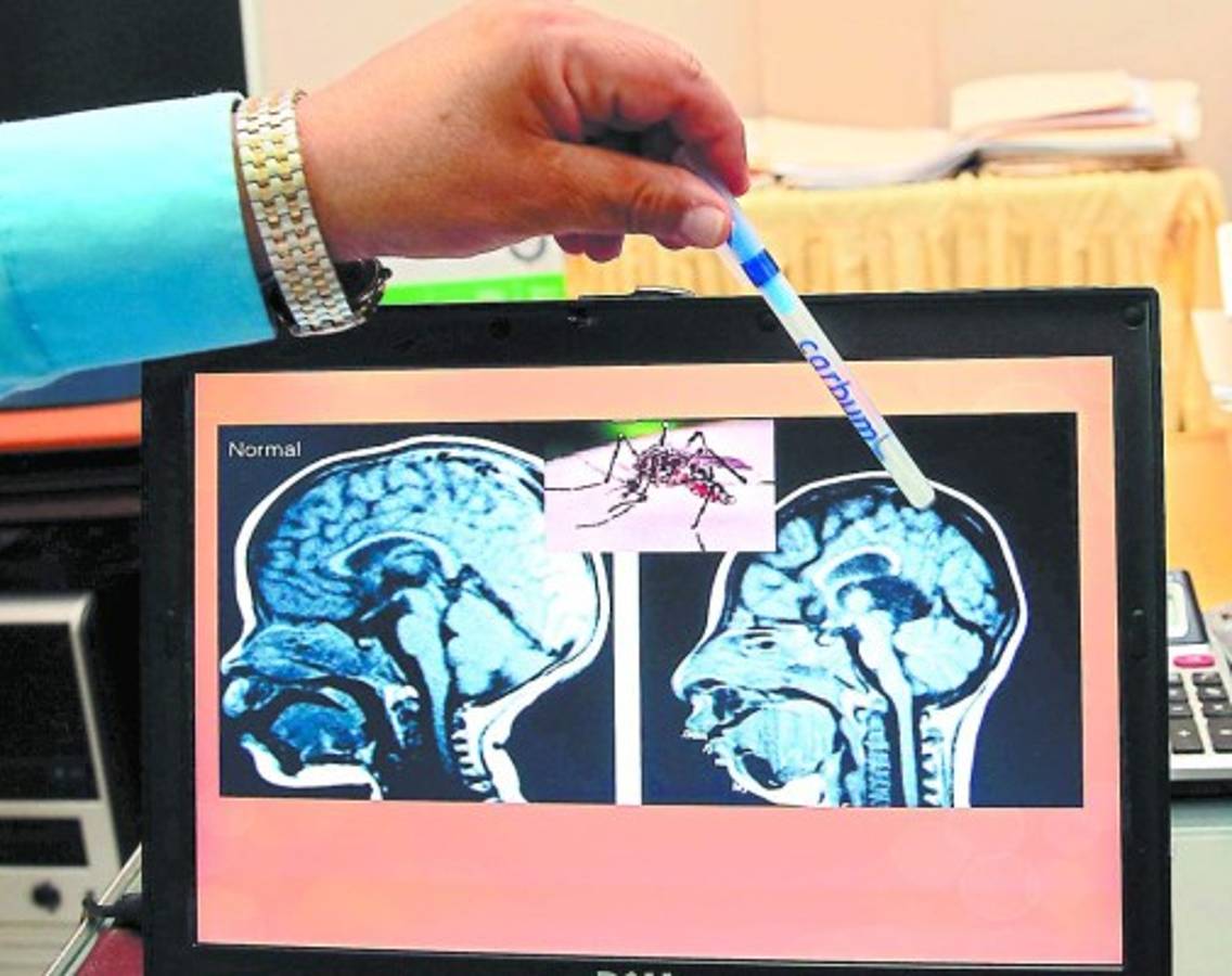 Monitorearán el tamaño de cabeza de recién nacidos