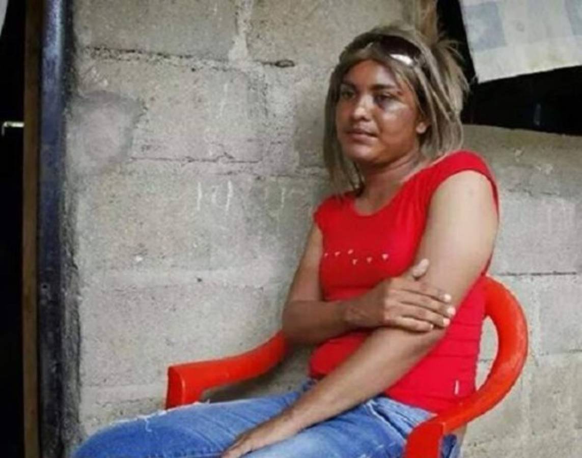 Fiscal instruyó ejercer acción penal en caso de gay agredido