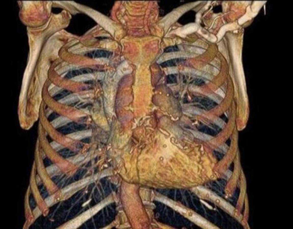 El cuerpo humano por dentro como nunca lo has visto