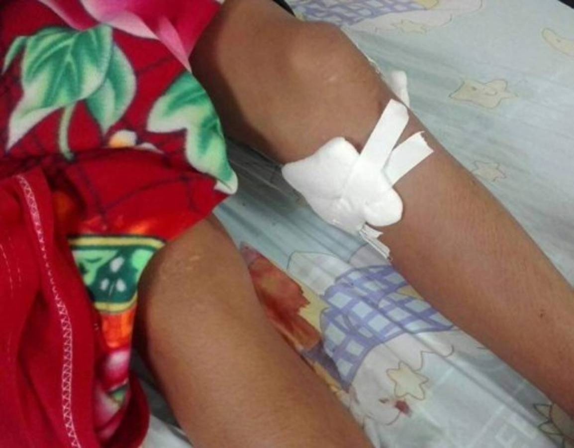 Catorce quemados por pólvora durante las fiestas