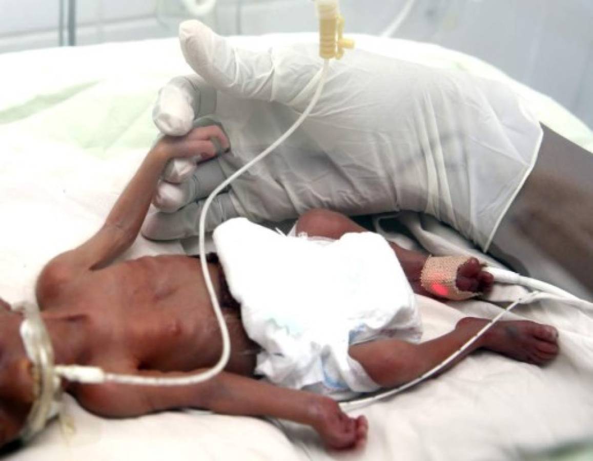 Murió bebé prematuro tras cuatro días de valiente lucha