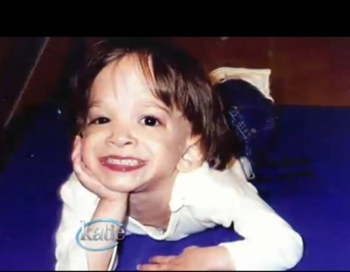 Muere la mujer que dejó de crecer a los dos años