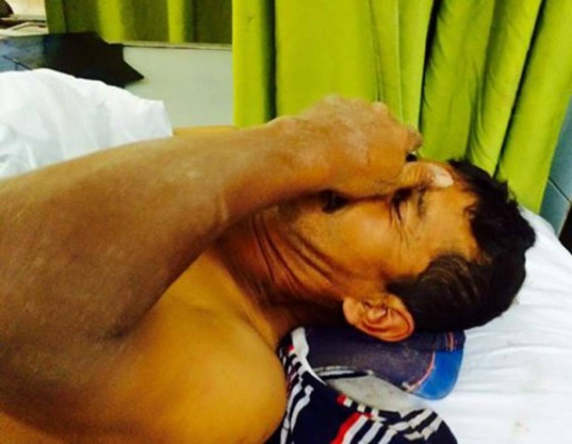 Rescatan a hombre soterrado tras caer muro en colonia Cataluña