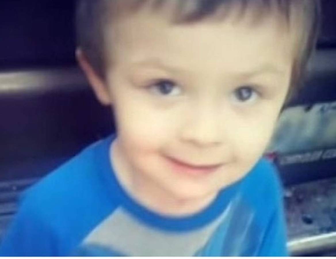 Un niño muere por ingerir canela en polvo