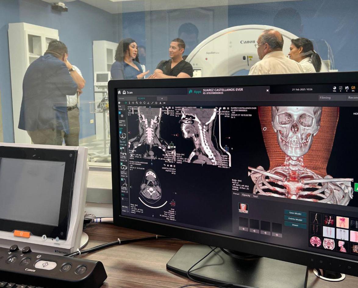 Hospital Materno Infantil estrena tomógrafo con inteligencia artificial