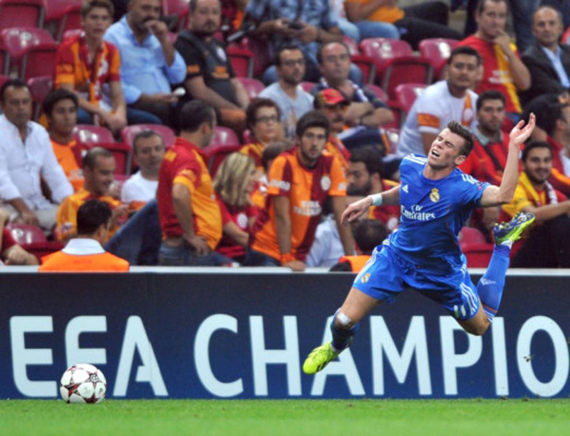 Gareth Bale sufre sobrecarga muscular