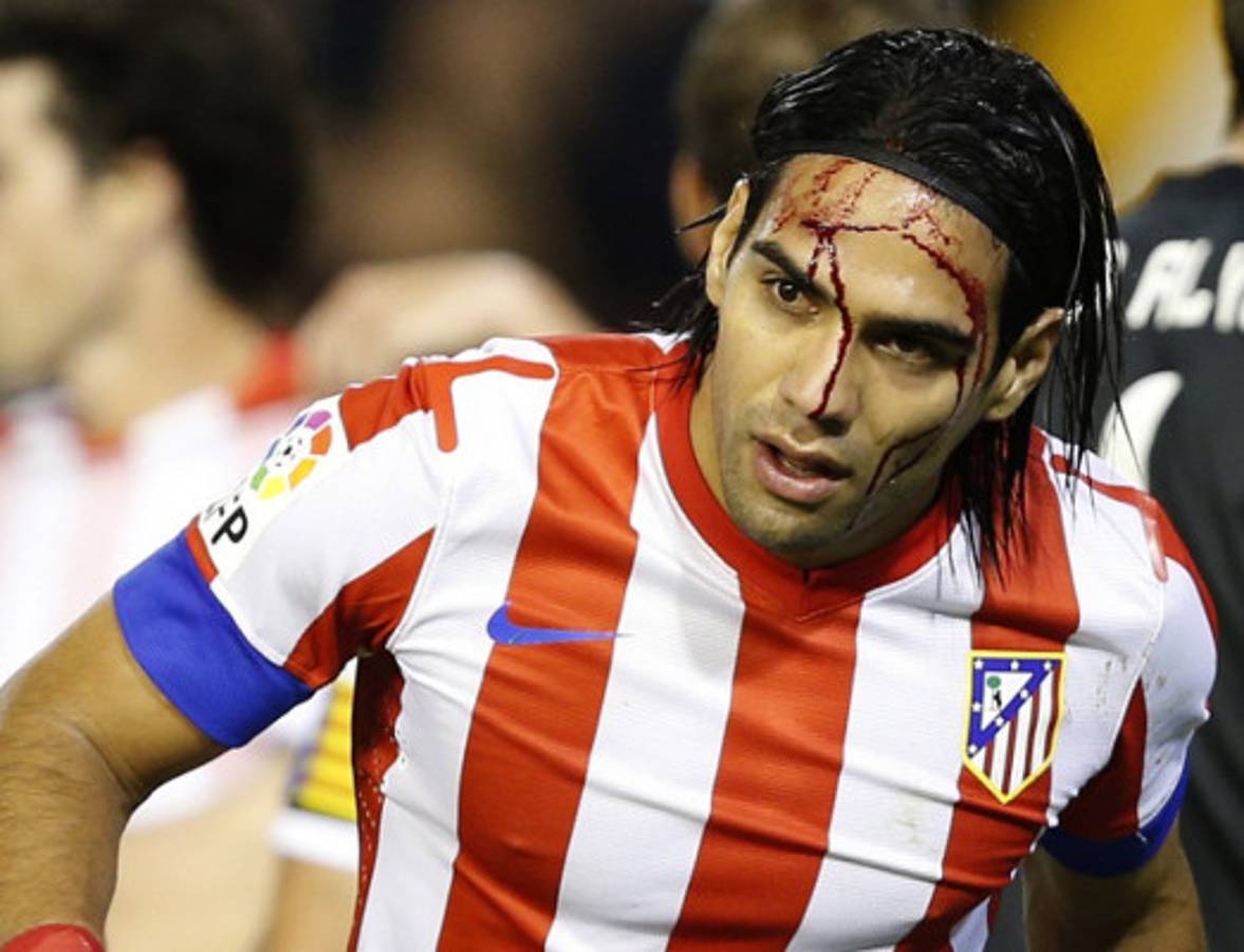 Valencia acaba con invicto del Atlético; Falcao sangra...