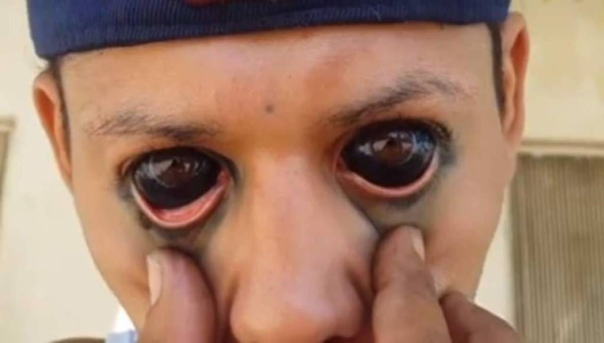 FOTOS: Así era Braulio Bustillo, el hondureño que se tatuó los ojos y fue asesinado