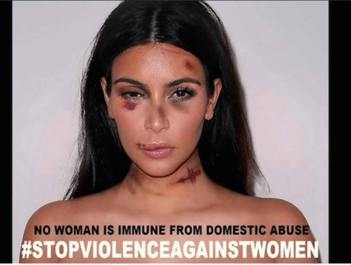 Campaña muestra fotos de celebridades como si fueran víctimas de violencia doméstica