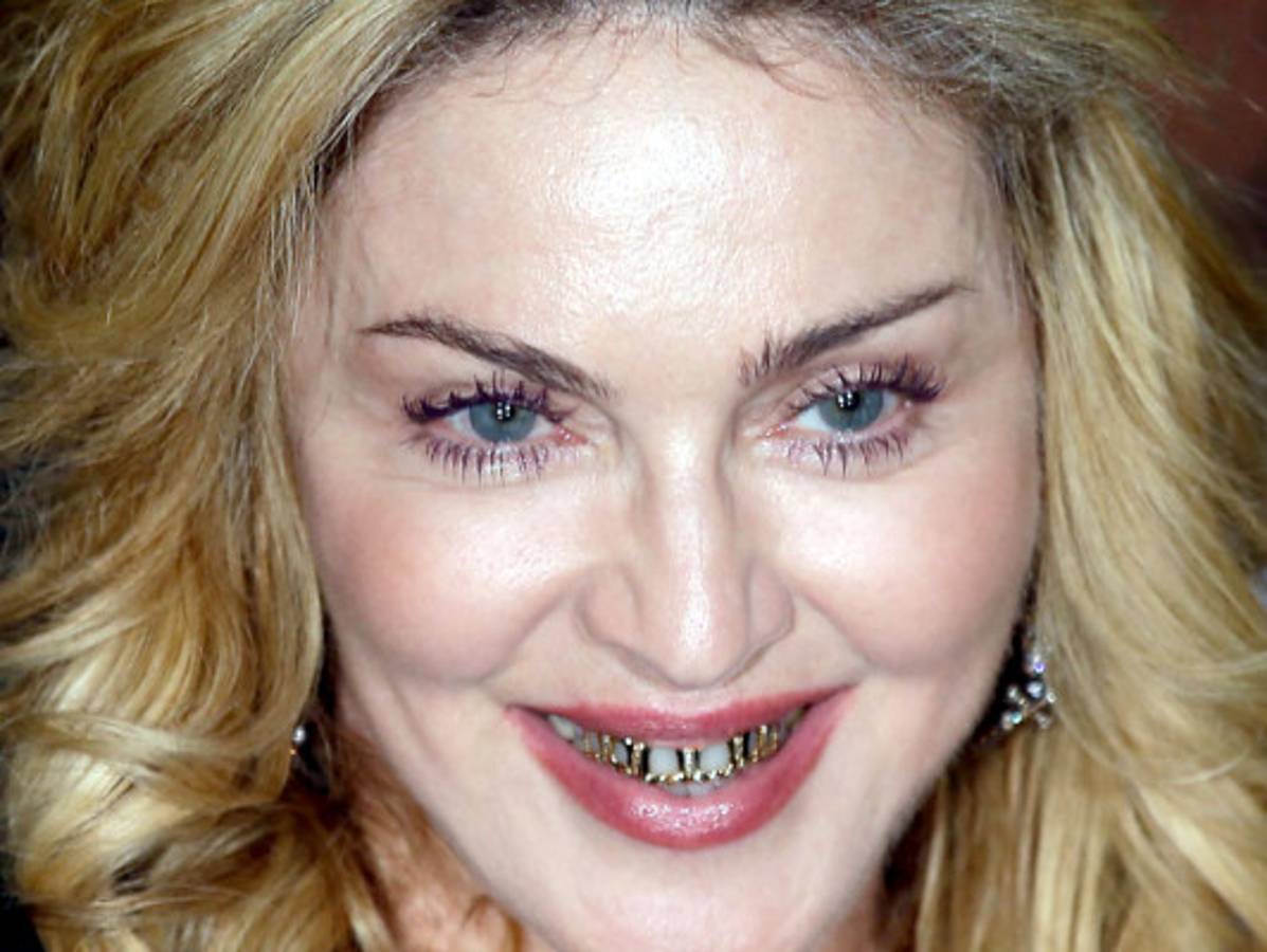 Fotos: La polémica dentadura de oro de Madonna