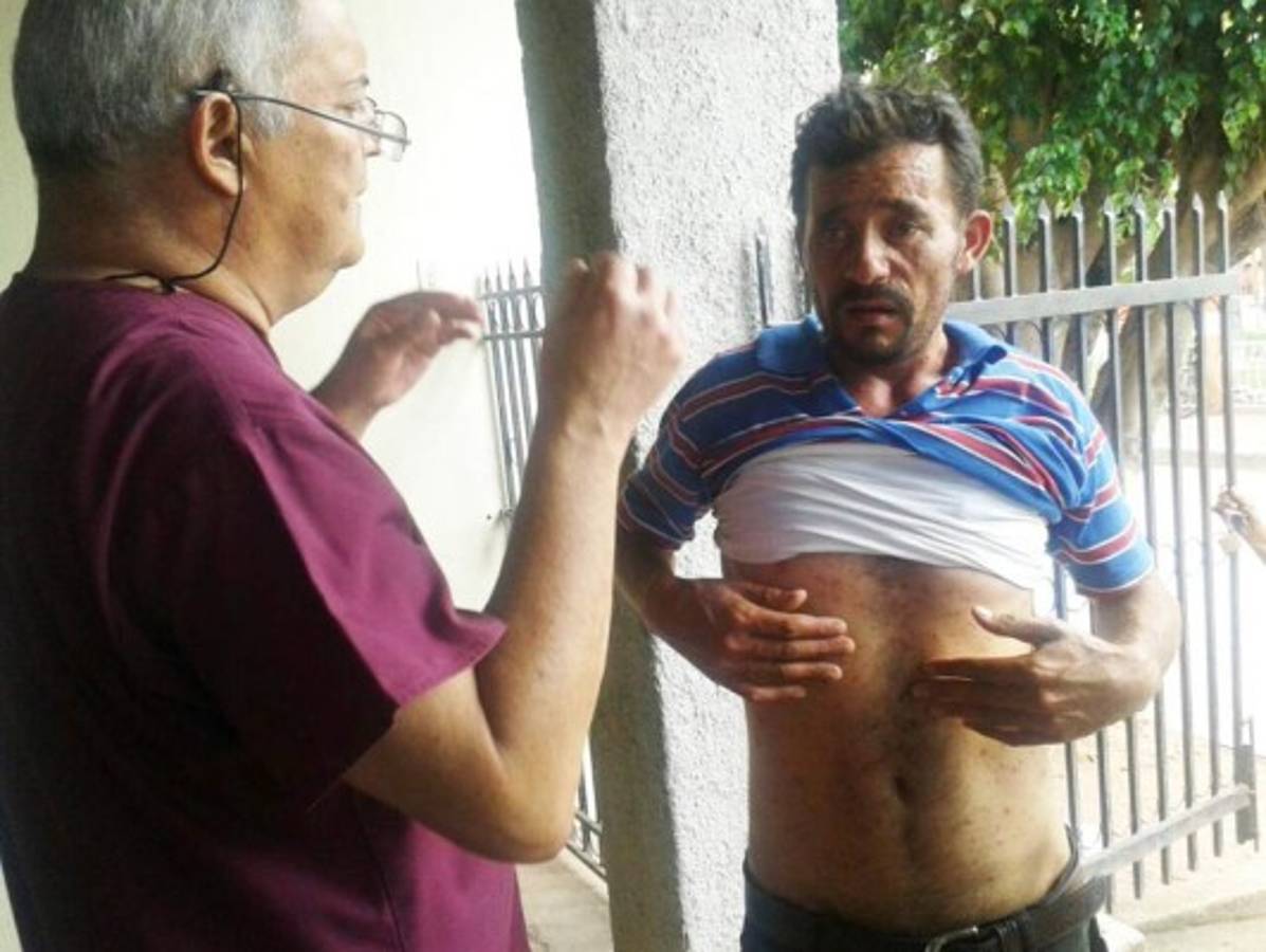 Honduras: Alarma por Chikungunya en la Villa de San Francisco